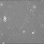 世界で最初に培養されたヒトの癌細胞（HeLa細胞）