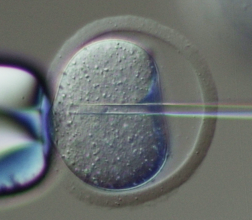 顕微授精の画像