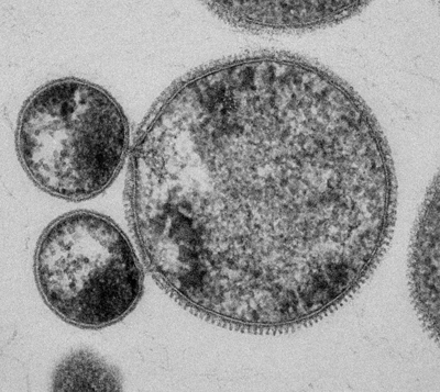 Nanobdella aerobiophila JCM 33616T(左側の二つの小さな細胞)
