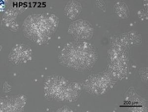 Spinocerebellar degeneration patient-derived iPS cells